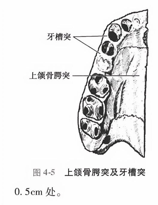 上颌骨腭突及牙槽突0.5cm 处。