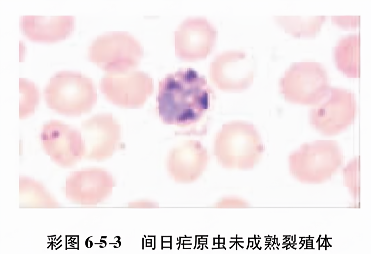 间日疟原虫未成熟裂殖体
