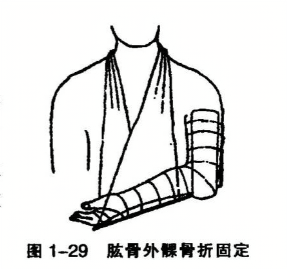 肱骨外髁骨折固定