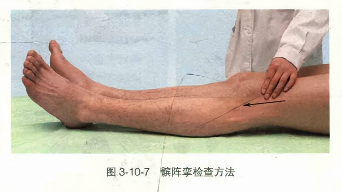 髌阵挛检查方法