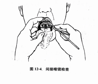 间接喉镜检查