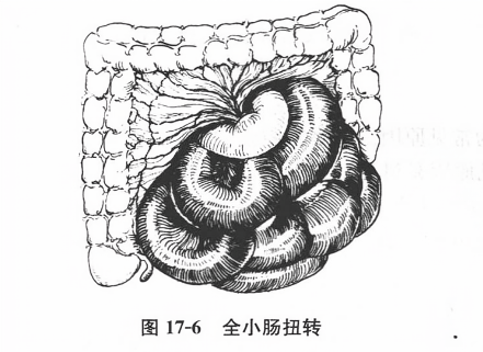 全小肠扭转