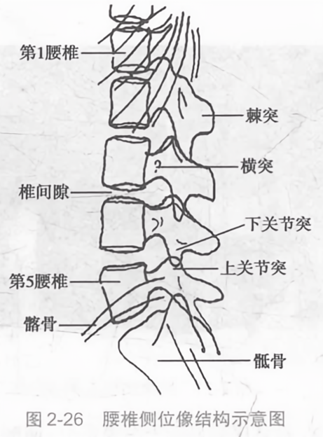 腰椎侧位像结构示意图