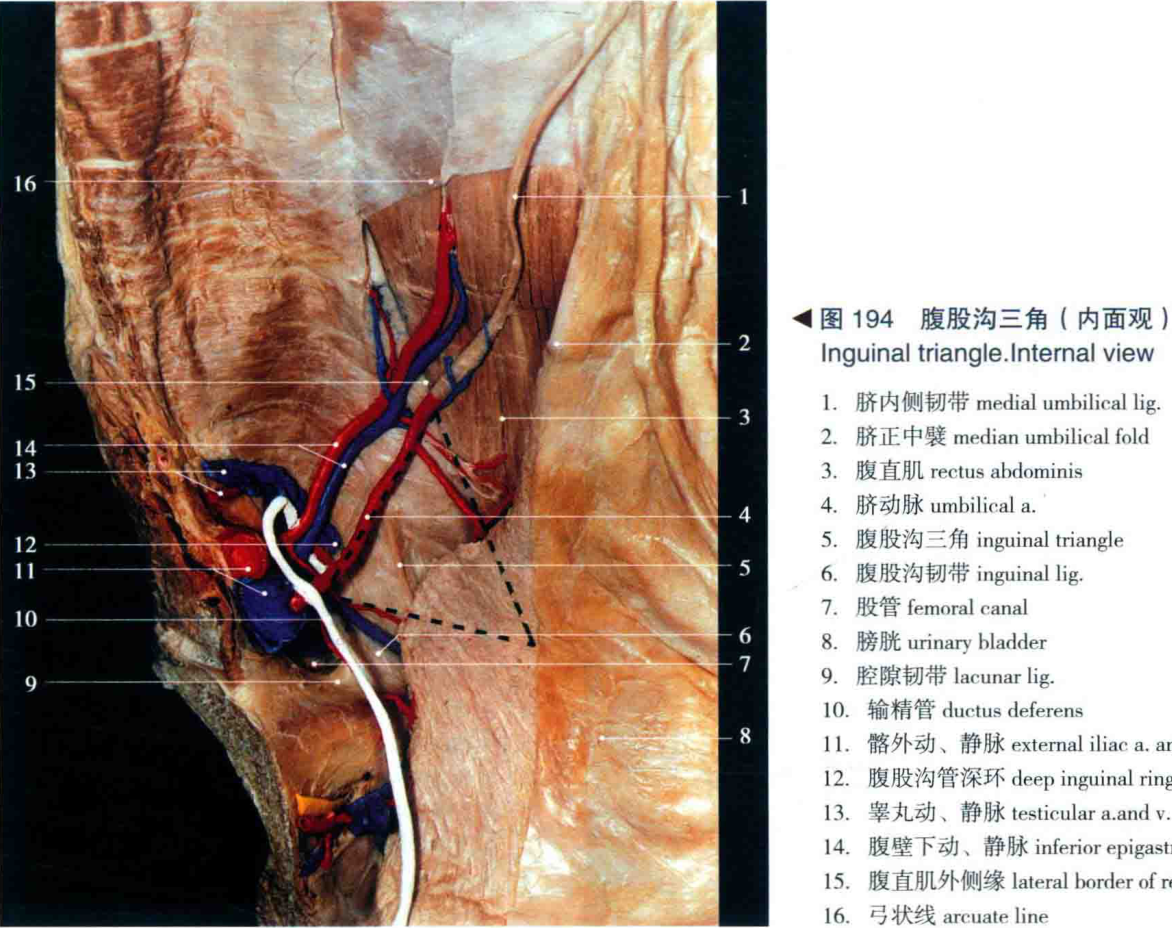 图194 腹股沟三角 (内面观) inguinal triangle.internal view