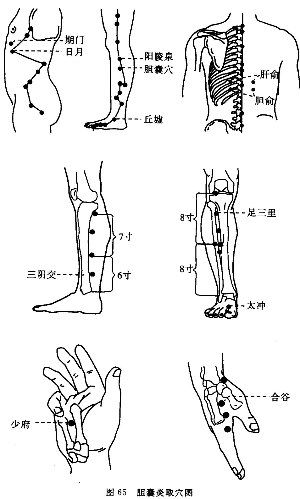 图 65 胆囊炎取穴图