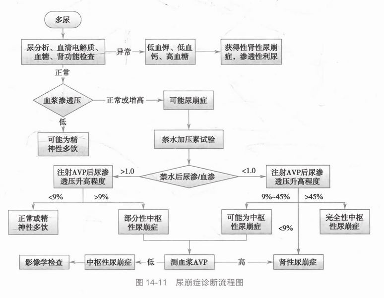 尿崩症诊断流程图