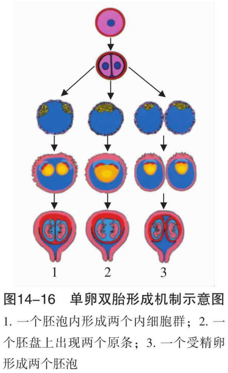 图14-16 单卵双胎形成机制示意图 1.一个胚泡内形成两个内细胞群;2.一 个胚盘上出现两个原条;
