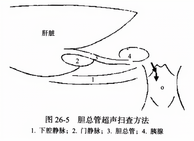 胆总管超声扫查方法