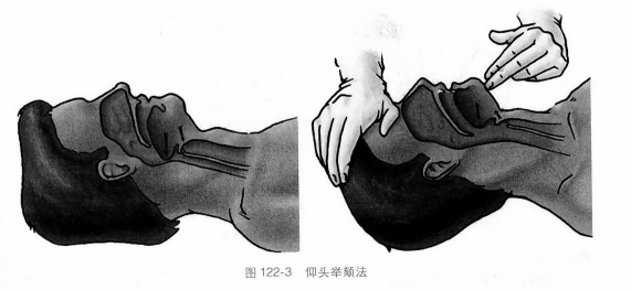 仰头举颏法