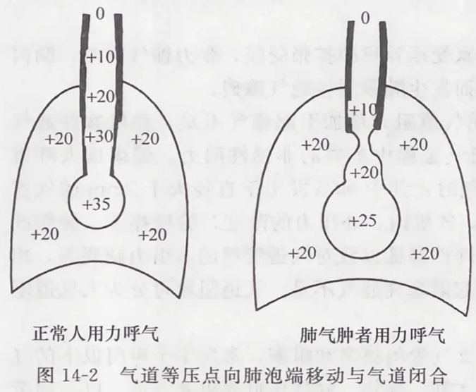气道等压点向肺泡端移动与气道闭合