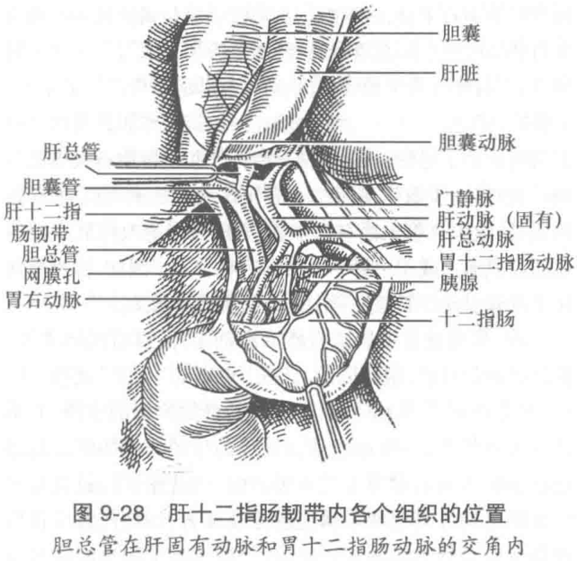 图9-28 肝十二指肠韧带内各个组织的位置 胆总管在肝固有动脉和胃十二指肠动脉的交角内