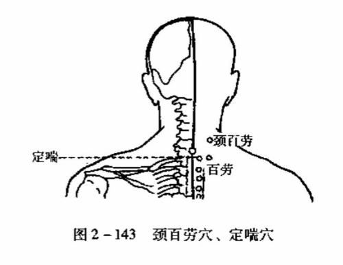 颈百劳穴、定喘穴