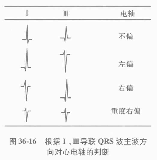 ¸ù¾ýióµ¼áª qrs ²ö÷²·½ïò¶ôÐäµçöáµäåÐ¶